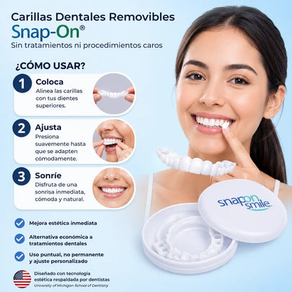 Carillas Dentales Removibles – Sonrisa Perfecta al Instante.