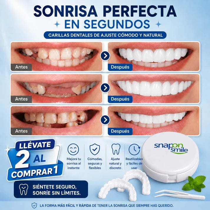 Carillas Dentales Removibles – Sonrisa Perfecta al Instante.